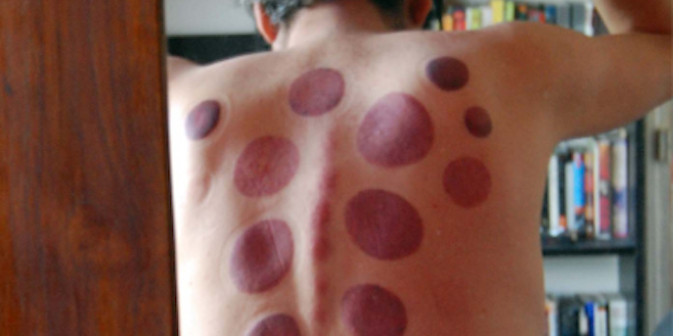 Homepage article image